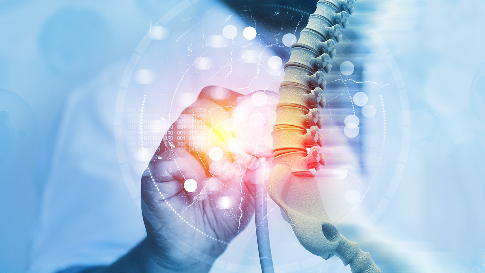 illustration of back problems such as sciatica or brachialgia