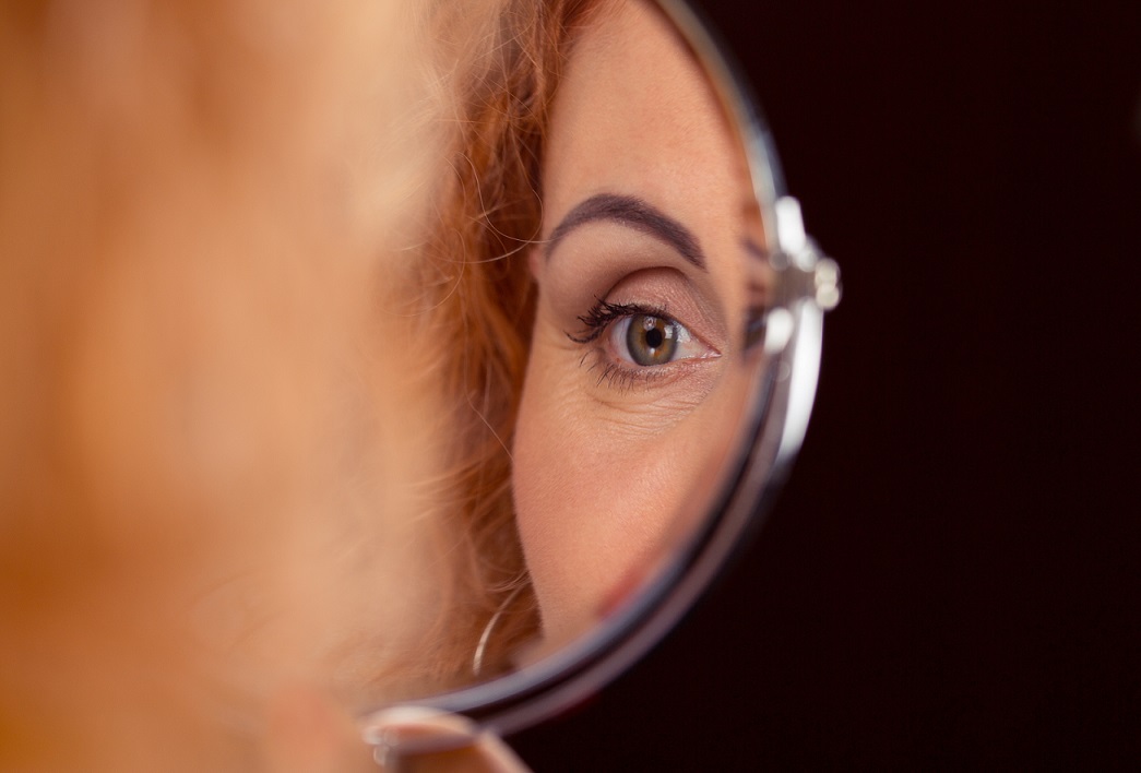Blepharoplasty