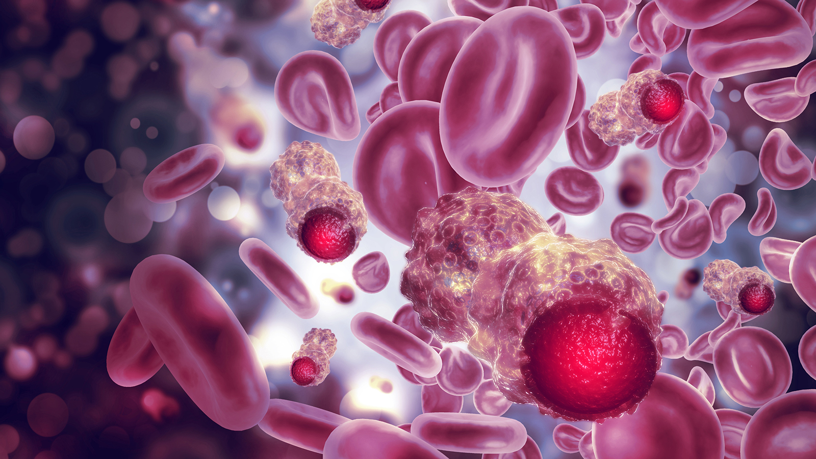 illustration of blood cancer