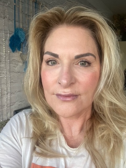 Blepharoplasty after