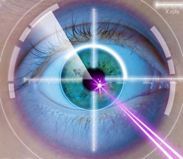 graphic showing how eyes are treated during laser eye surgery