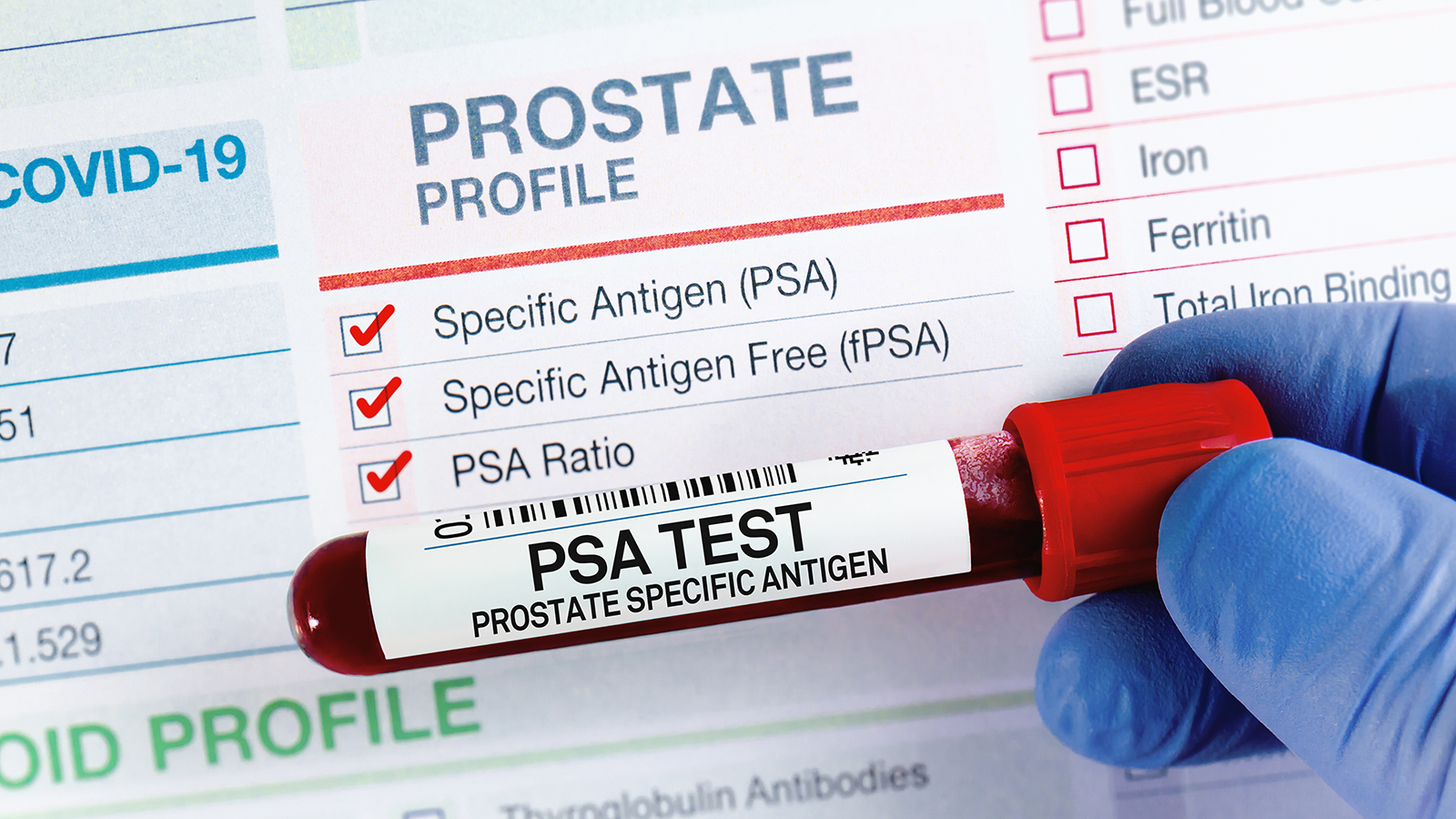 Probing Prostate What to expect from your prostate exam