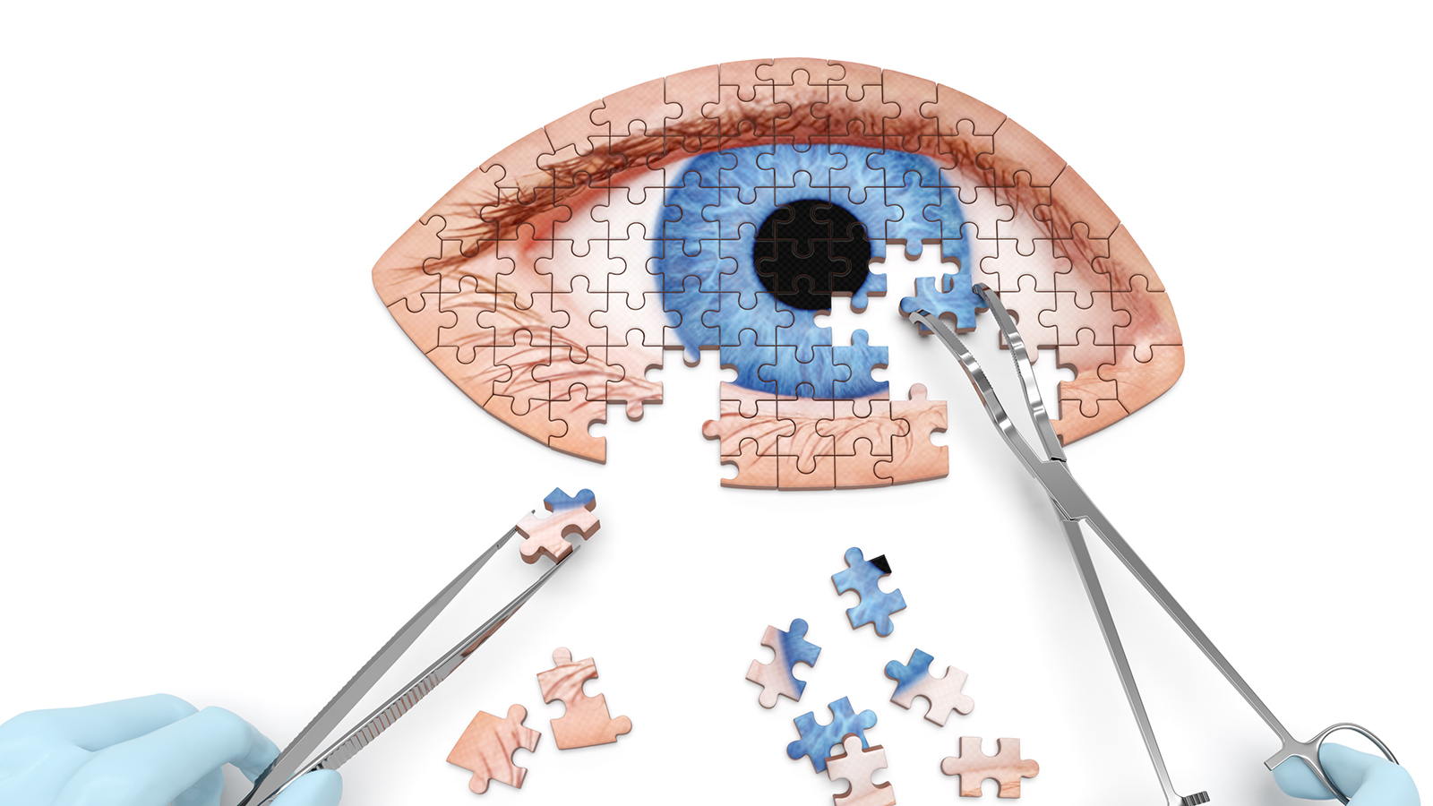 surgeon using tools to complete a jigsaw puzzle of a healthy blue eye