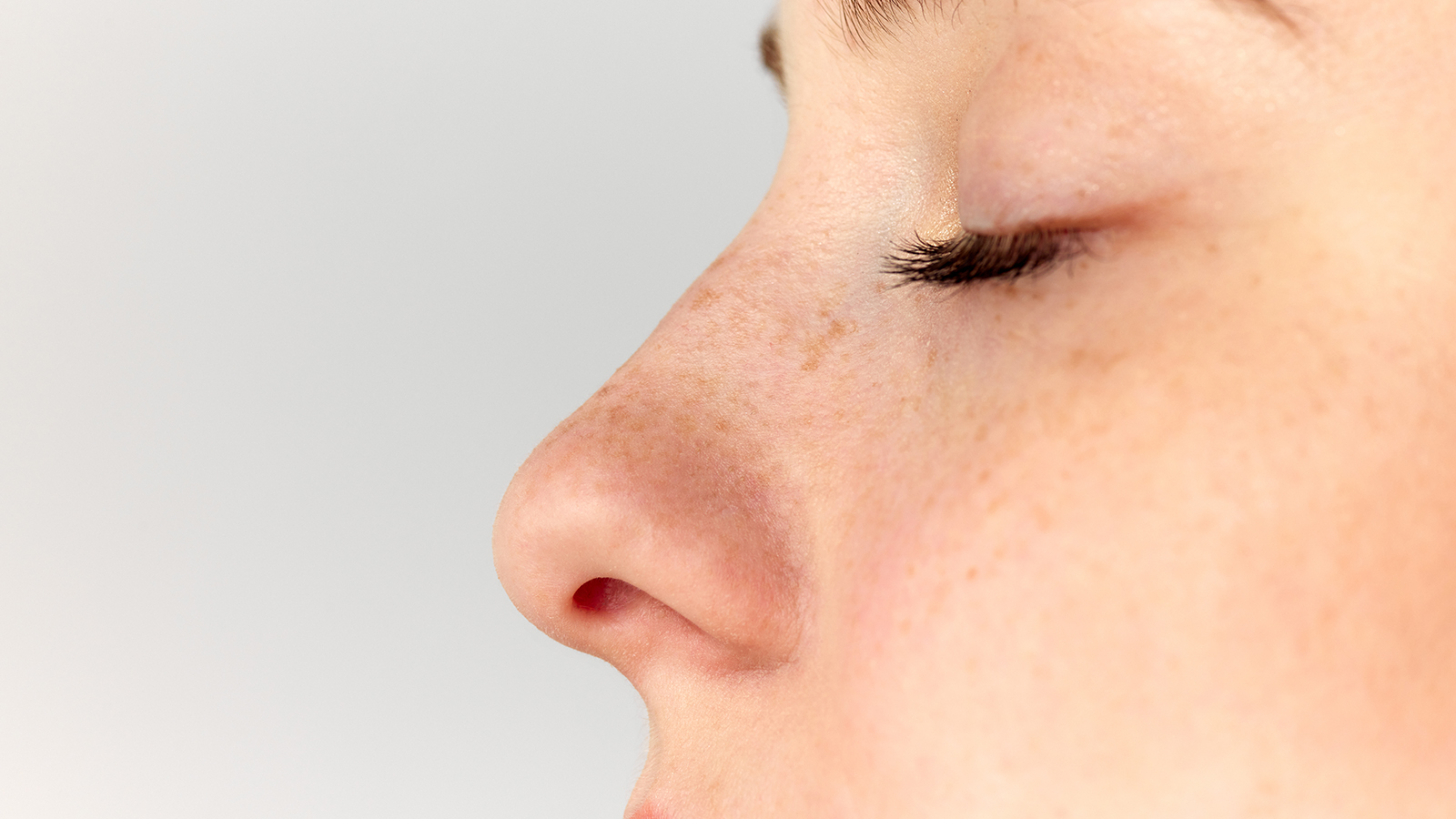 profile of a woman's nose after rhinoplasty