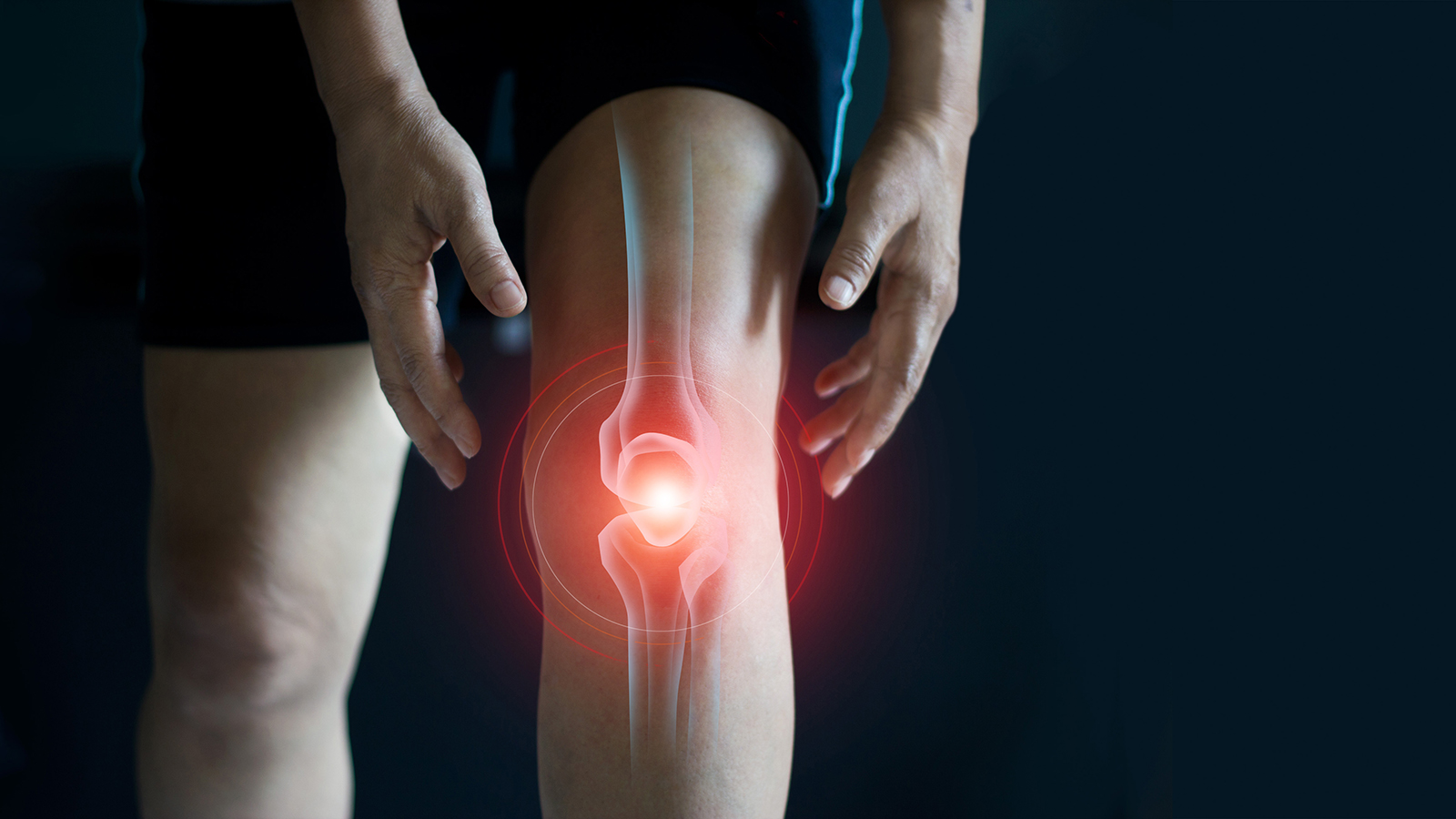 legs with an illustrated overlay showing knee pain