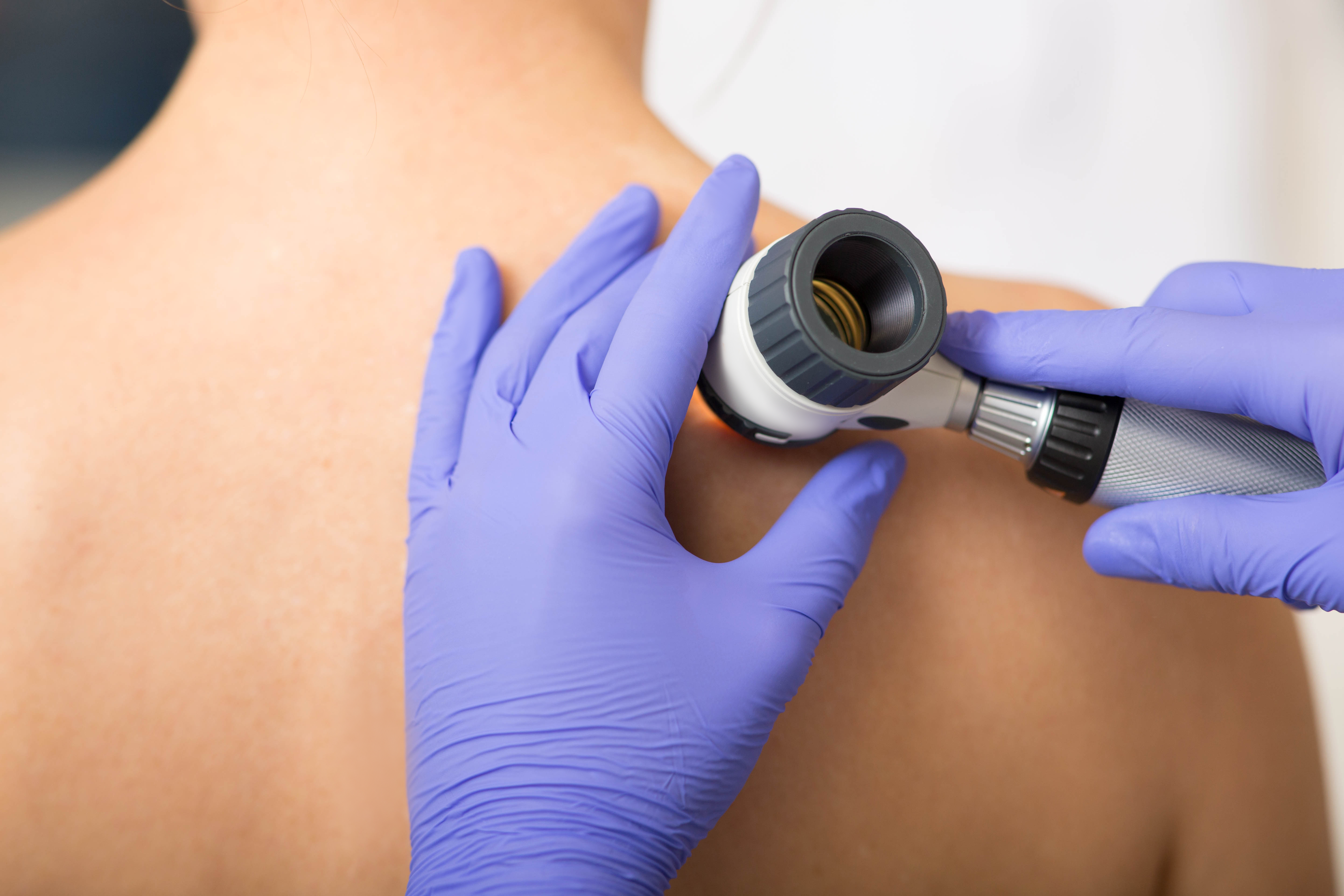 Dermatology-services-in-sheffield