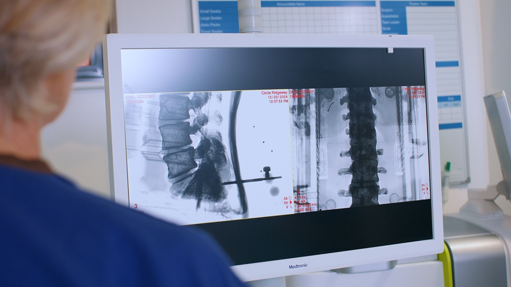 Robotic spinal surgery in Swindon Mazor™