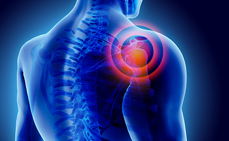 coping with rotator cuff injury illustration of an xray depicting pain in shoulder