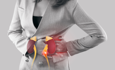 Woman suffering with kidney stones symptoms