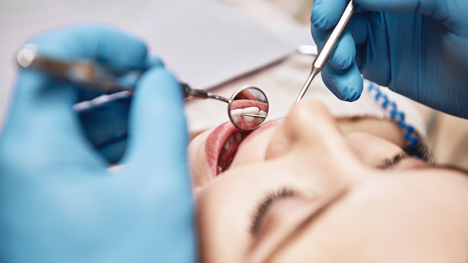 /-/media/circle/spotlights/image-spotlights/in-article-images/overcoming-dental-phobia-fear-of-the-dentist_3.jpg?rev=ff15be2d23f747a884f5449b2d2589a1&iar=1&mh=255&mw=381&hash=FB4F34D506AAF008EF6089ACE11415F4