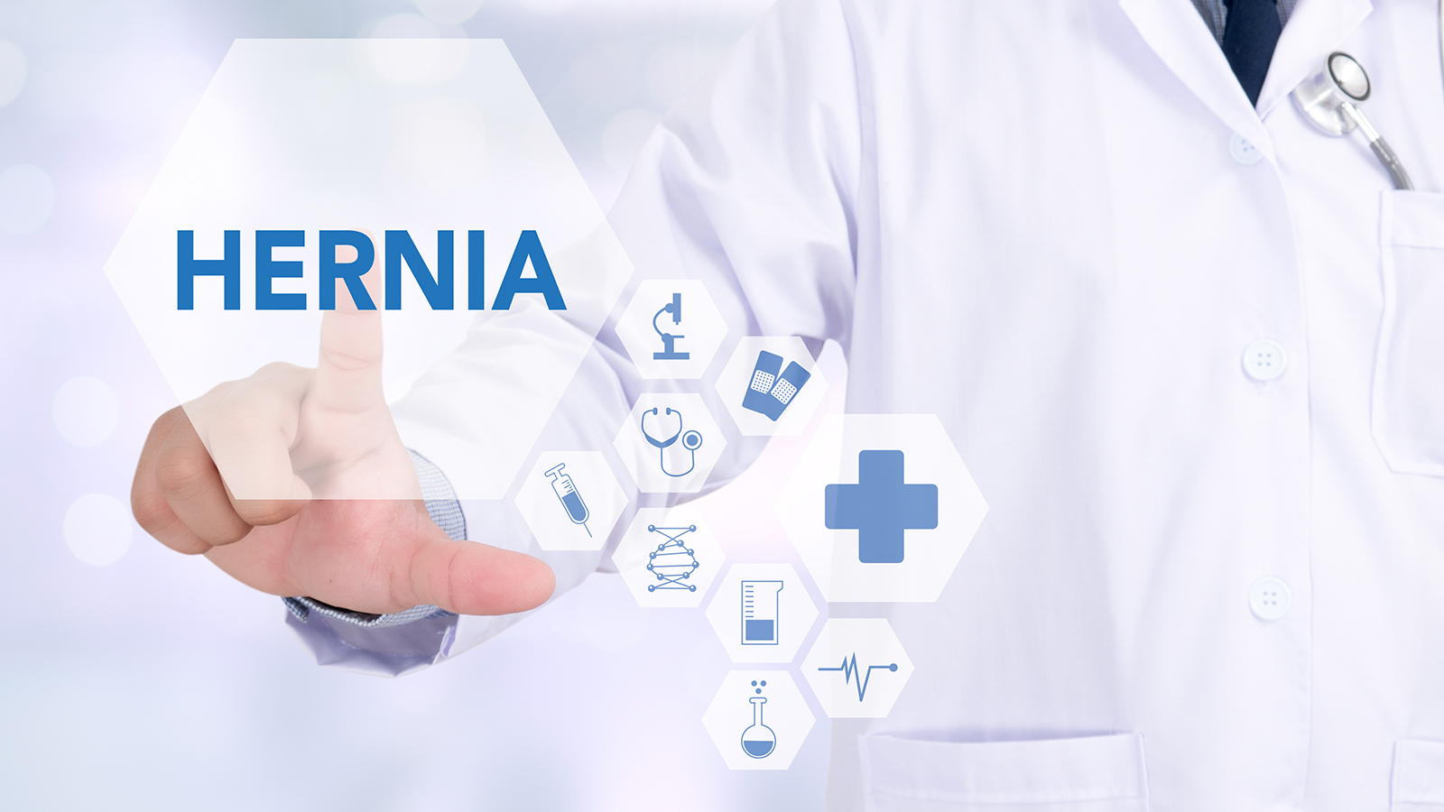 /-/media/circle/spotlights/image-spotlights/in-article-images/what-is-a-hernia-and-how-is-it-treated_3.jpg?rev=9e4ee1ffa5cd41f4b0a1fb83af4d592a&iar=1&mh=255&mw=381&hash=C3607C39371A3CB84CB59DBE804B2D2D