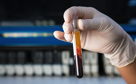 gloved hand in a lab holding a blood sample