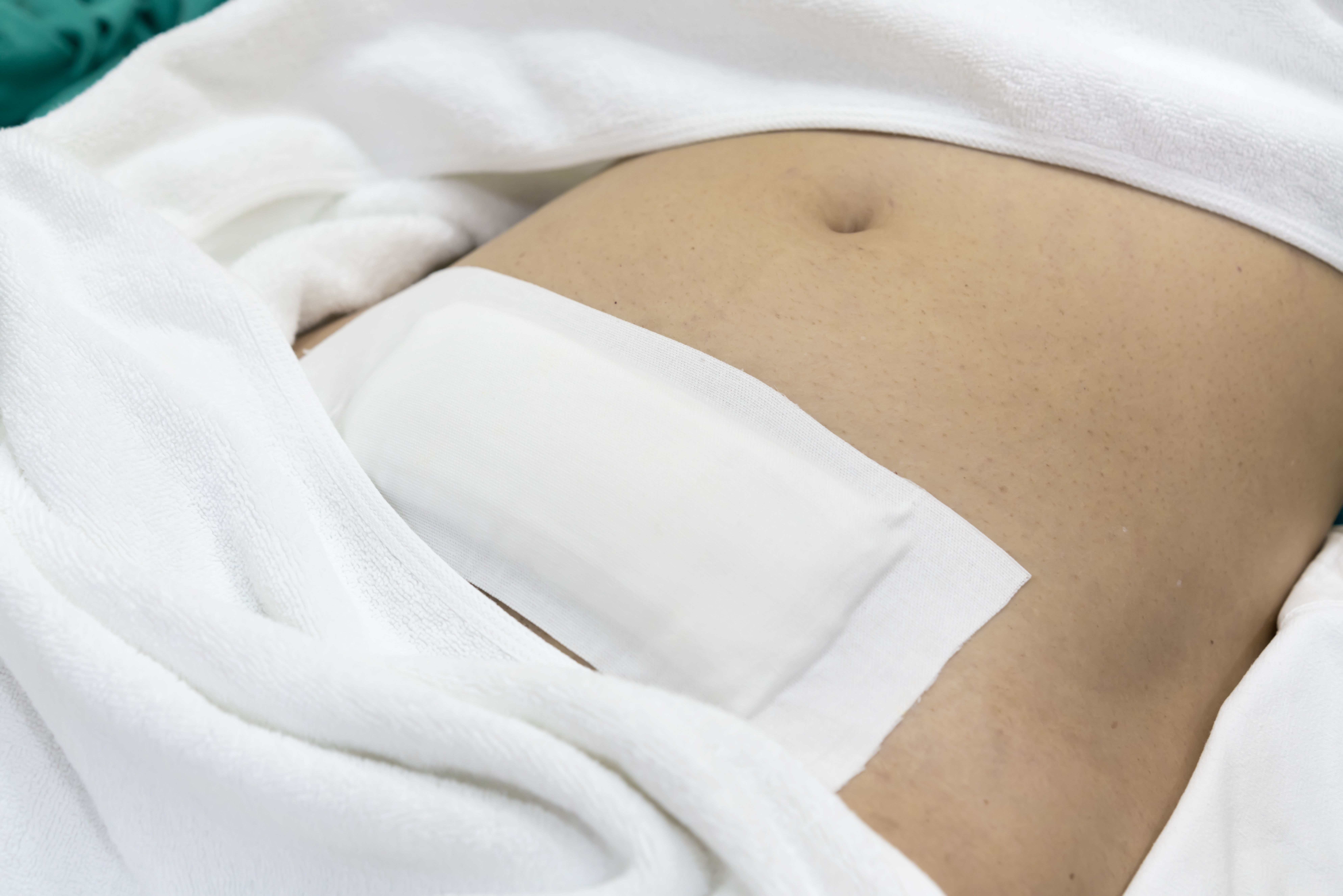 Patient given waterproof bandages for stitches after hysterectomy