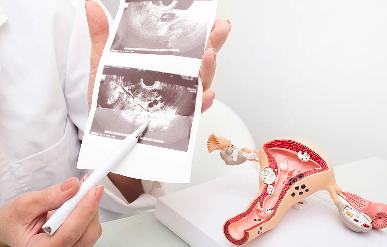 Doctor explaining uterus ultrasound scan with uterus model