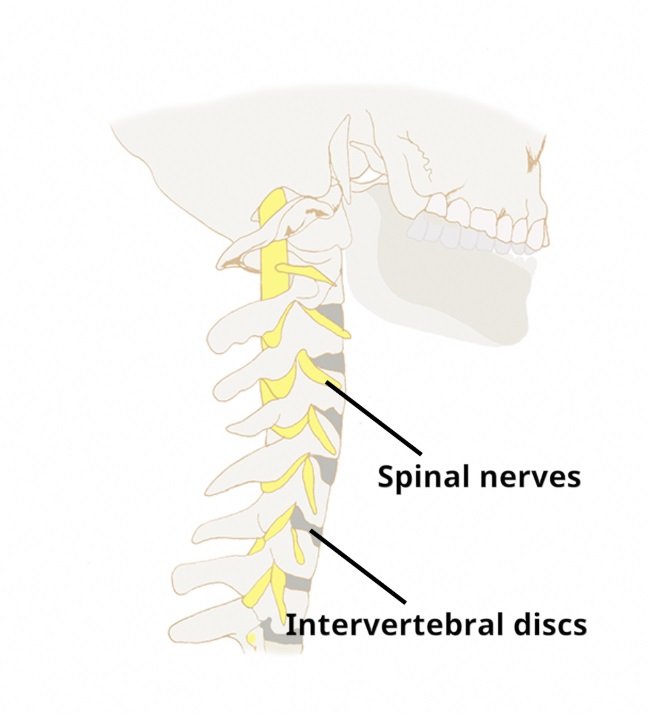 neck pain