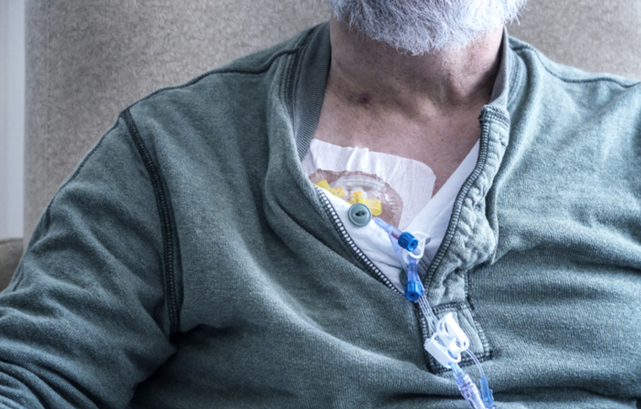 Male cancer patient undergoing intravenous chemotherapy treatment
