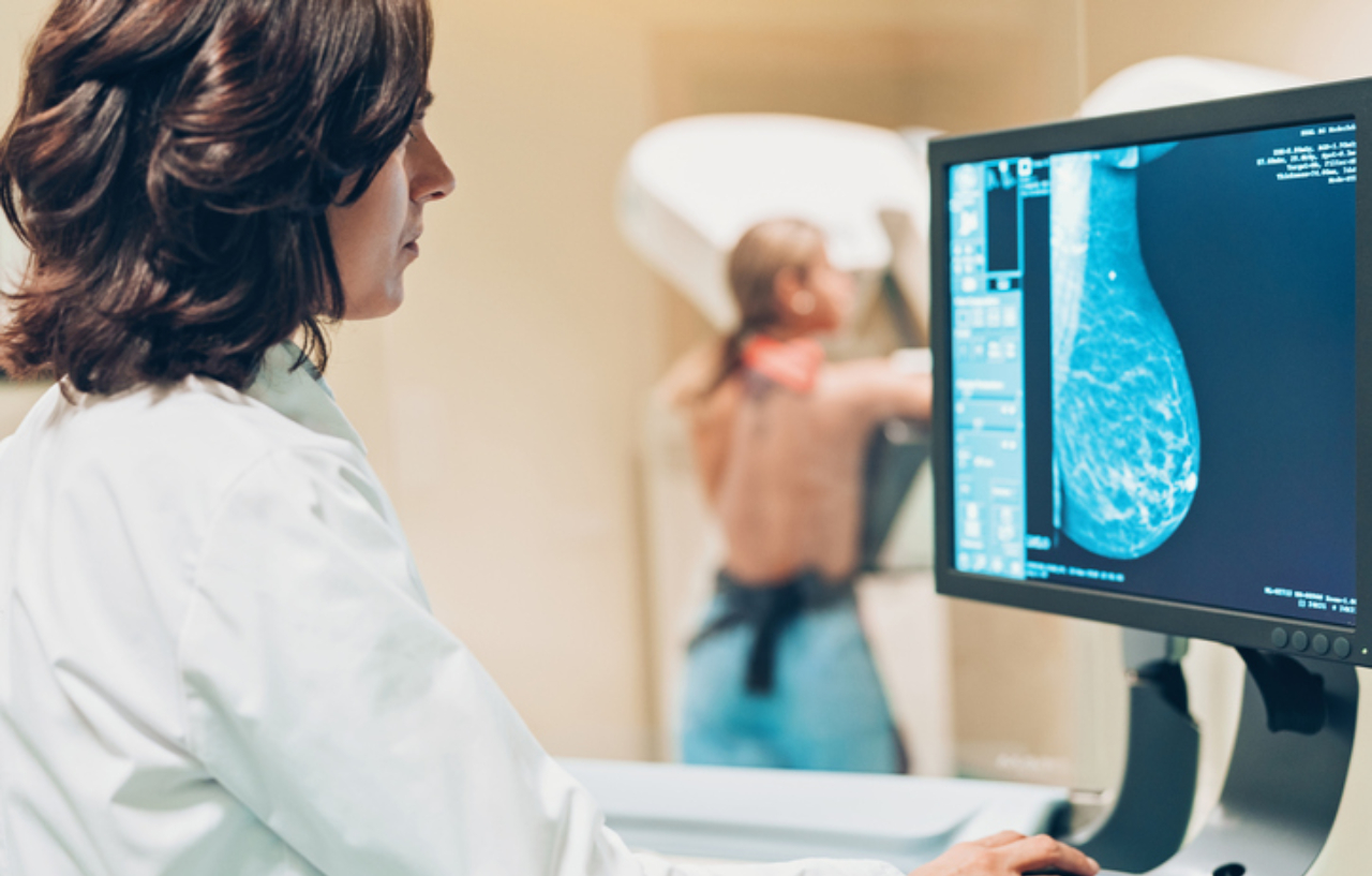Doctor examining a mammogram on a screen to assess the need for breast cancer treatment