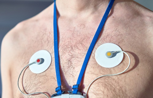 Ambulatory Electrocardiogram (ECG) Test | Cardiology