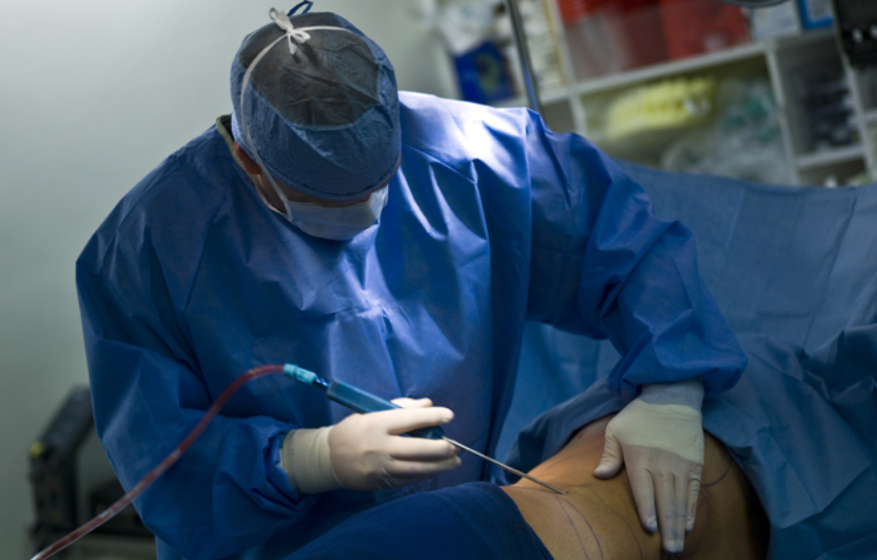 Body-jet liposuction being performed by a surgeon in blue scrubs