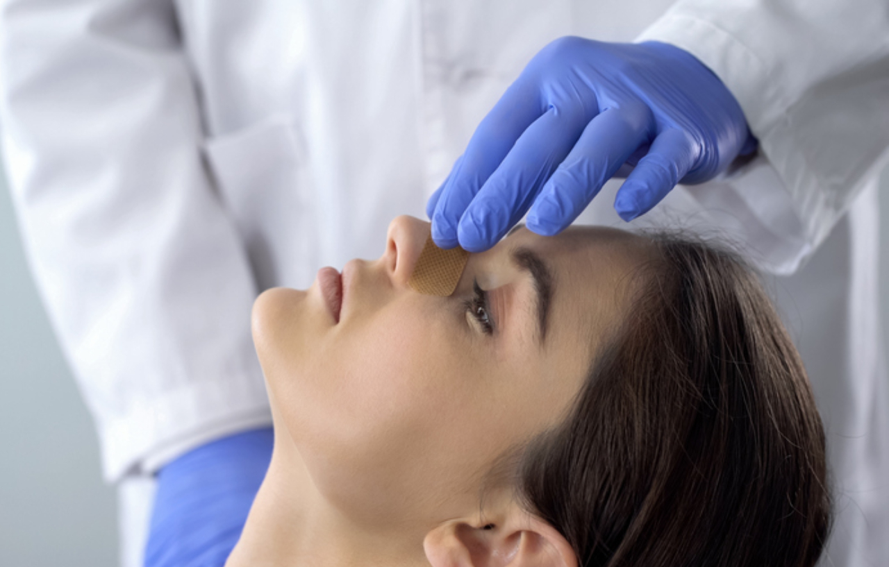 Doctor examining a patient's nose after a septorhinoplasty (nose surgery)