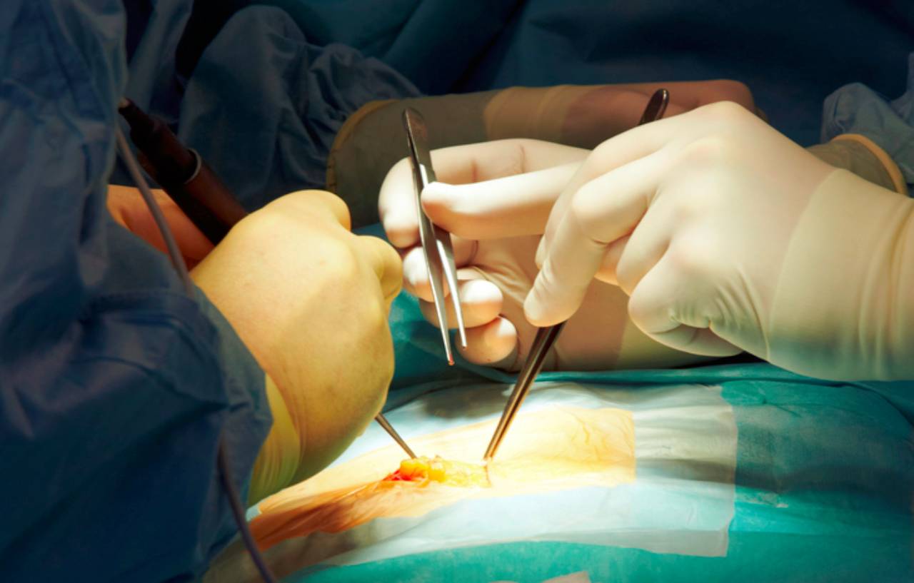 Surgeons operate as part of a sports hernia treatment plan