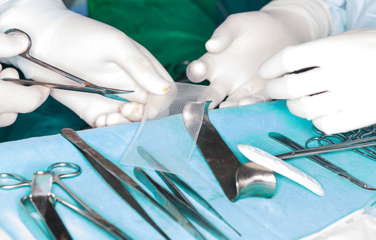 Doctors prepare the mesh that will be used in a hiatal hernia surgical procedure