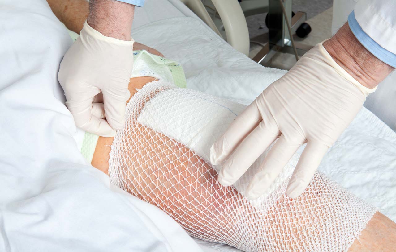 Bandaged-knee-after-knee-replacement