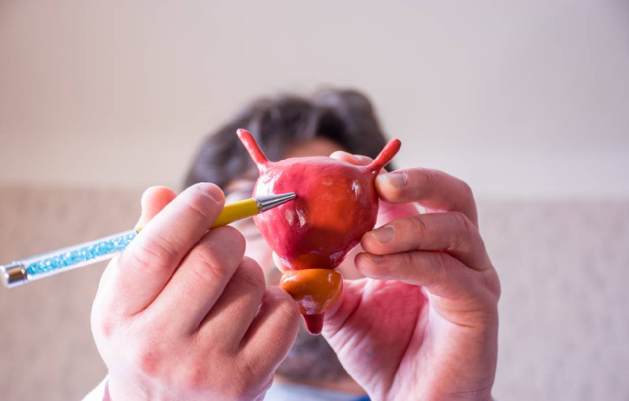 Doctor points to a model of a bladder to explain artificial urinary sphincter AUS surgery to a patient