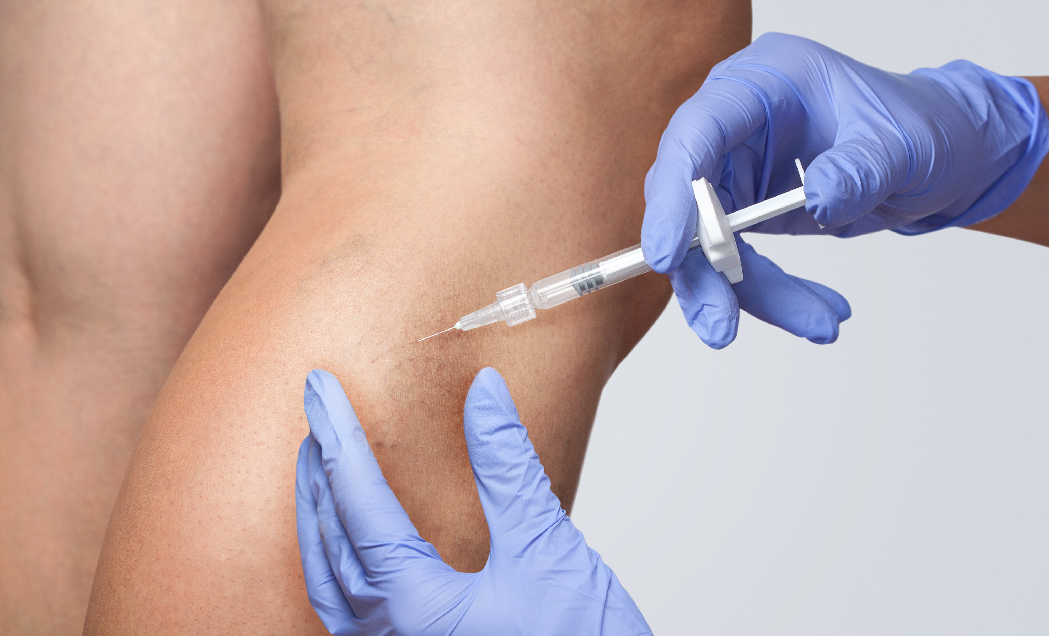 A medical professional injecting a patient's leg