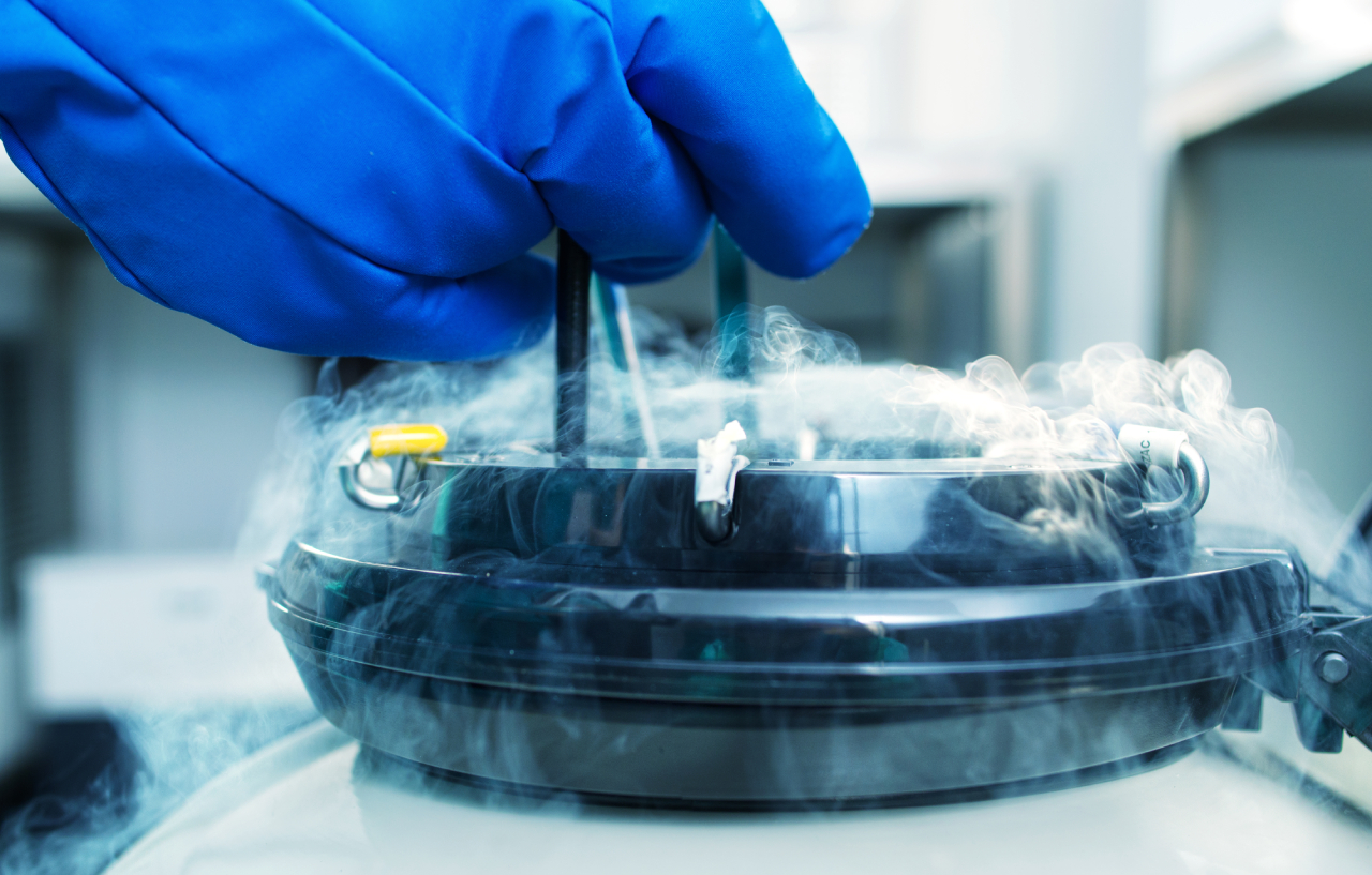 Sperm freezing procedure with a sample being placed into a liquid nitrogen vessel