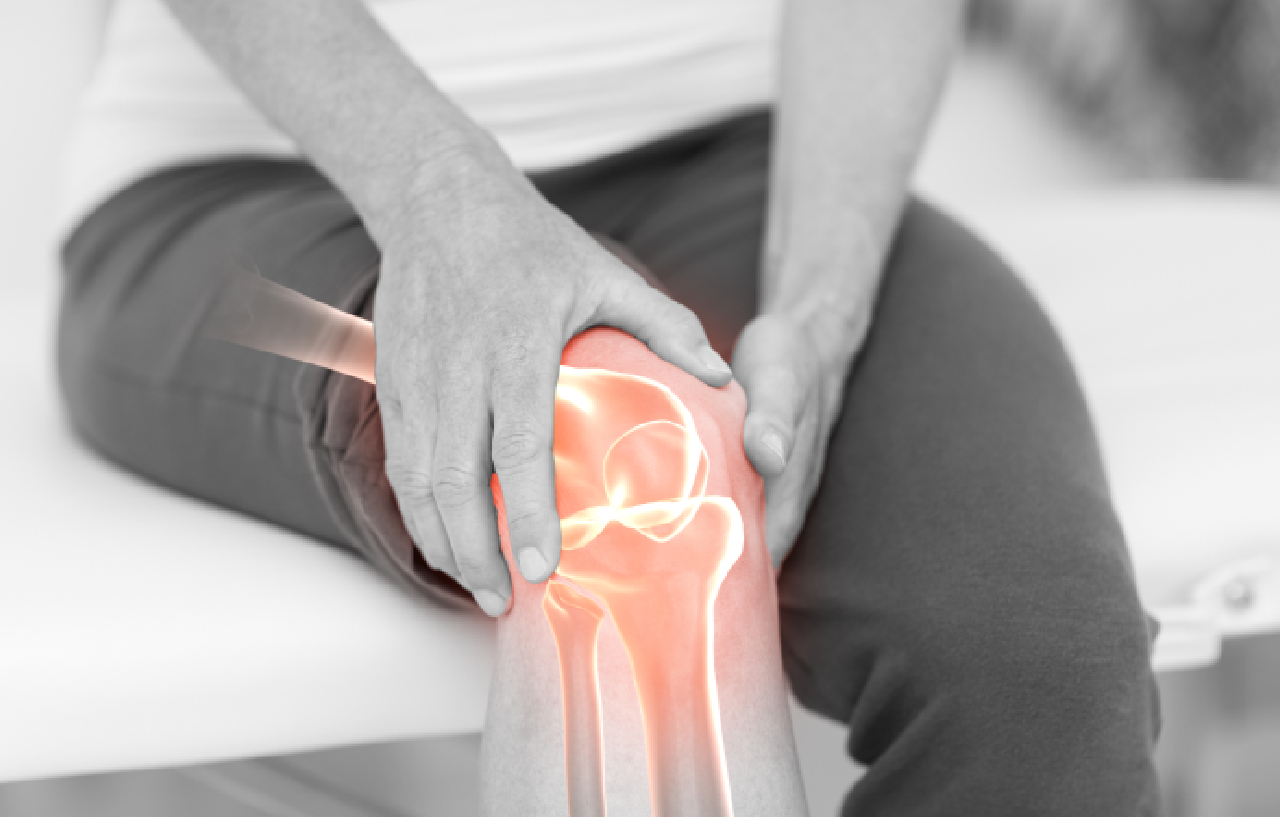 Knee pain x-ray