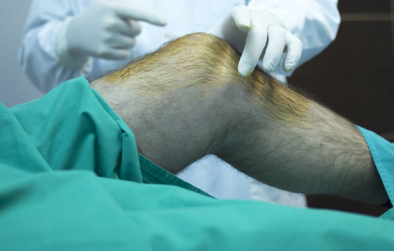 knee-and-hip-joint-models