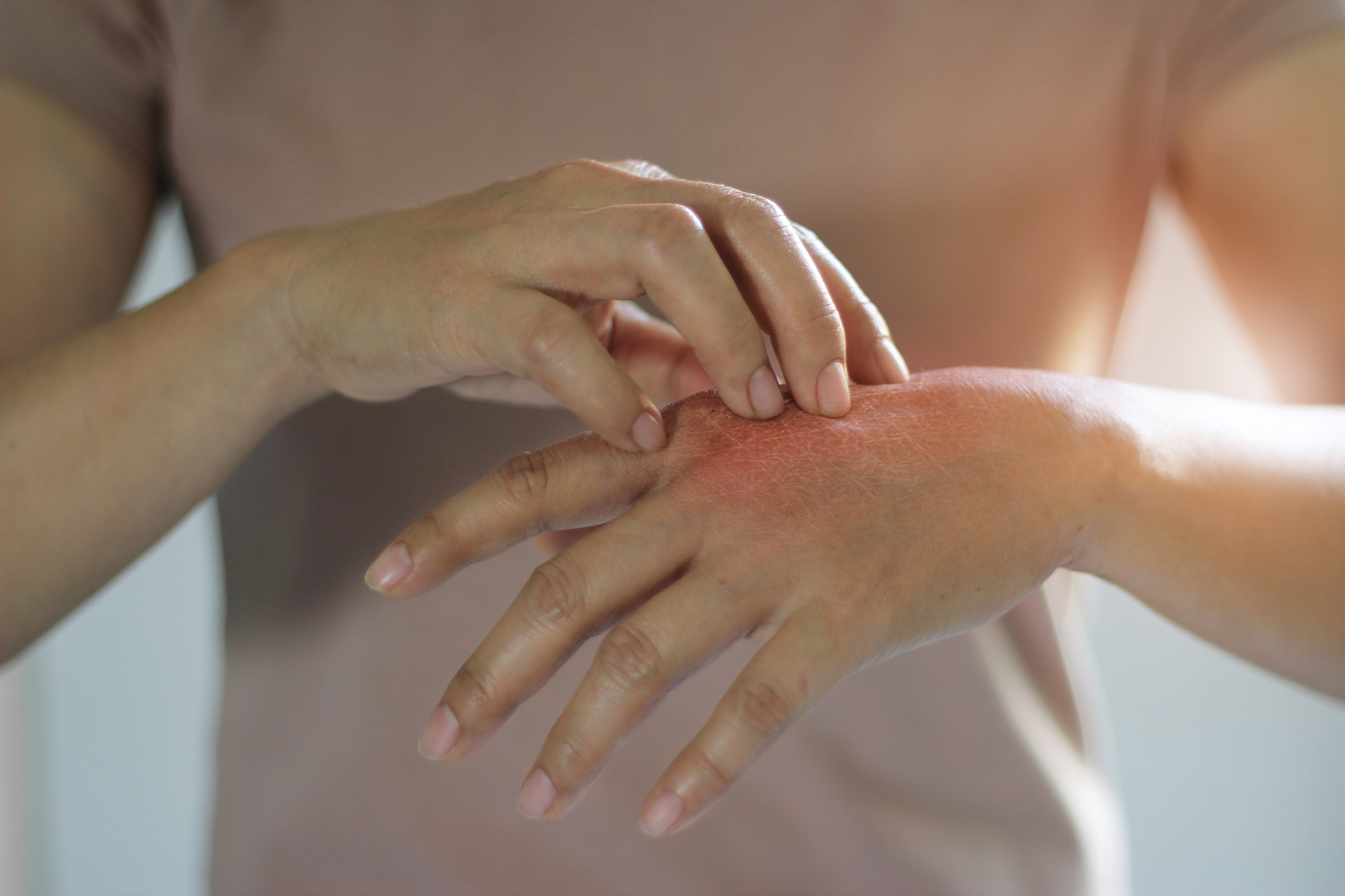 A woman scratching her hand 