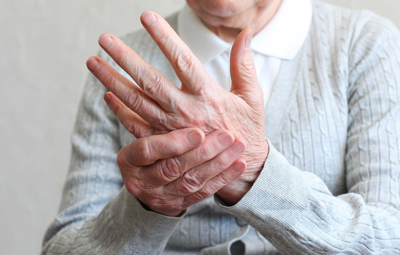 A man who needs hand surgery for Dupuytren’s contracture holds his painful hand