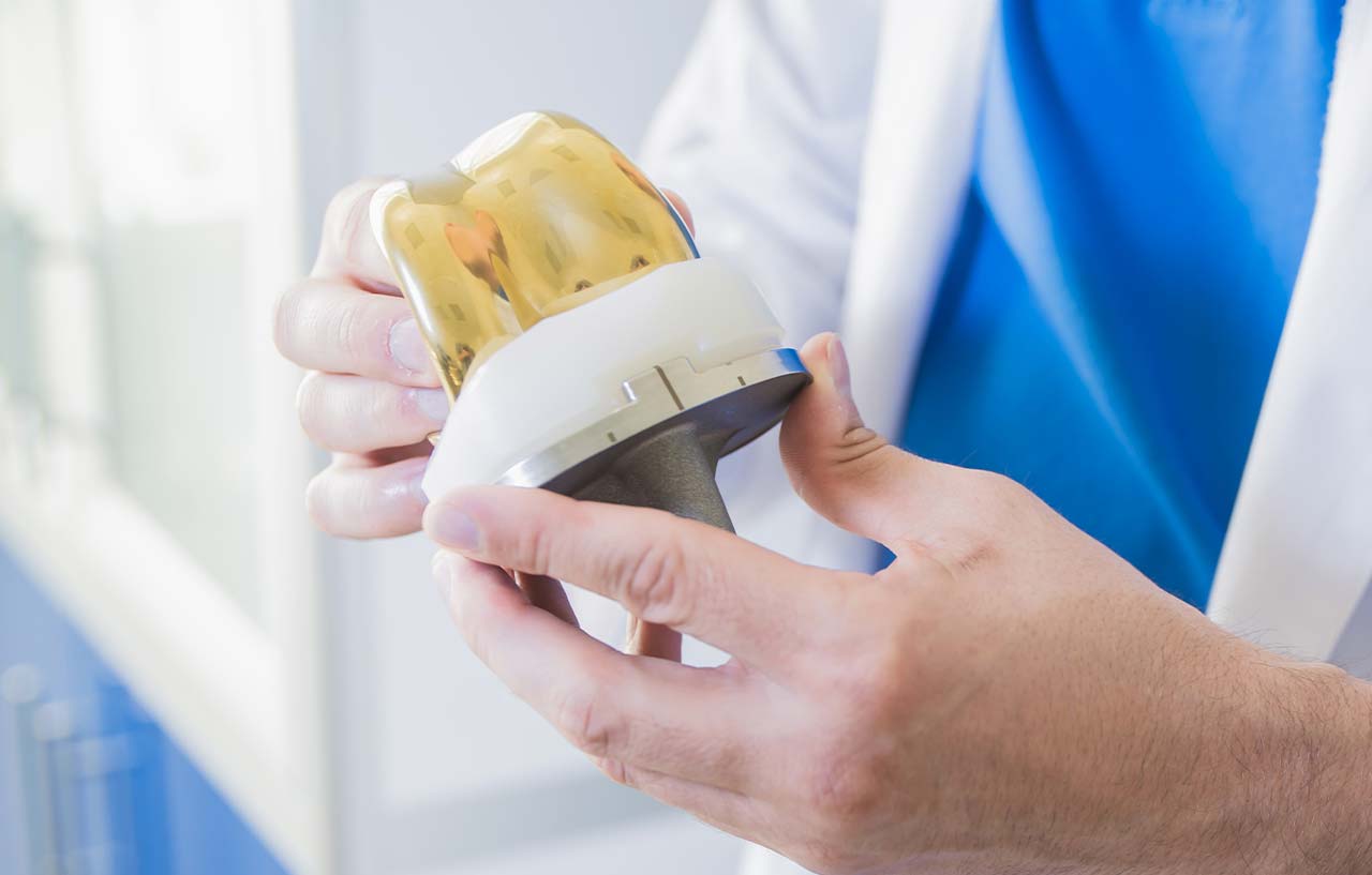 Surgeon holding knee replacement implant next to knee joint model