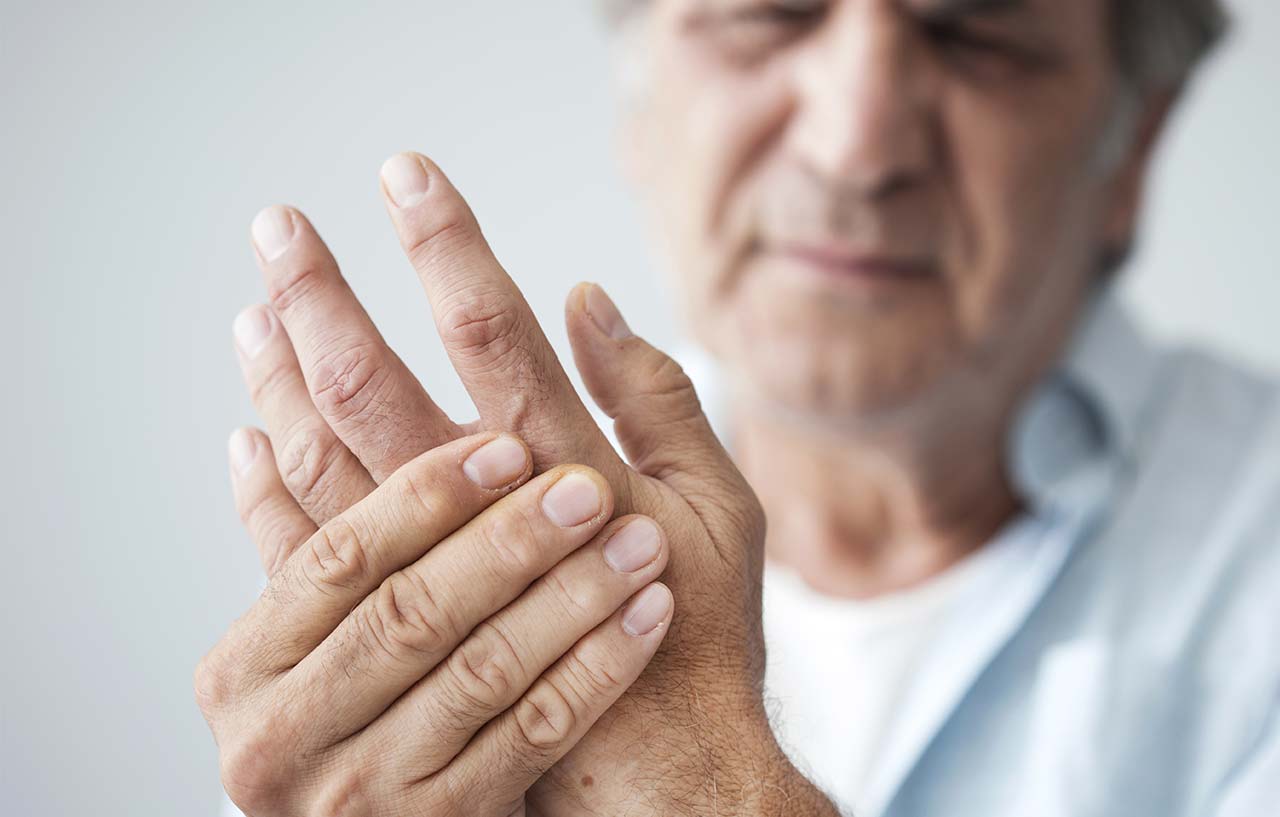 Man with rheumatoid arthritis holds his painful finger joints to the camera