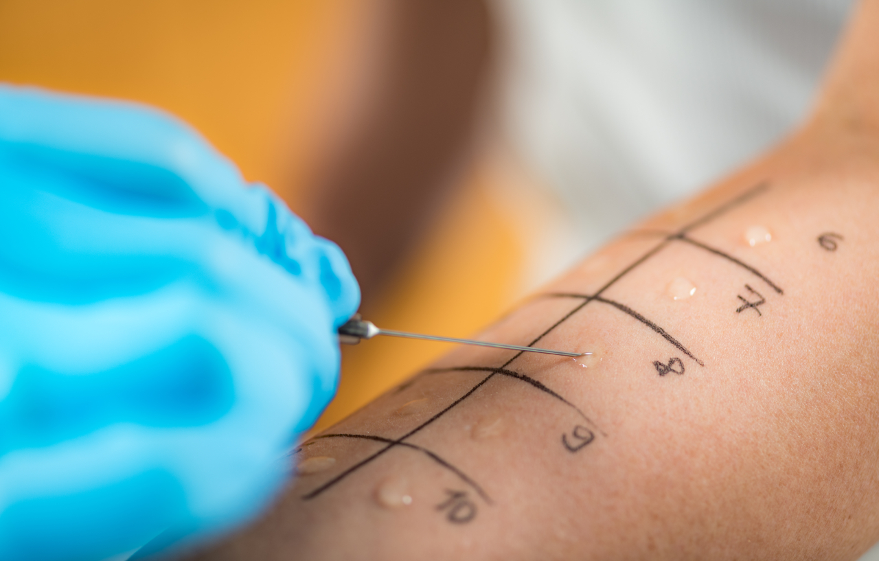 Doctor performing a skin prick test as part of a paediatric allergy treatment consultation