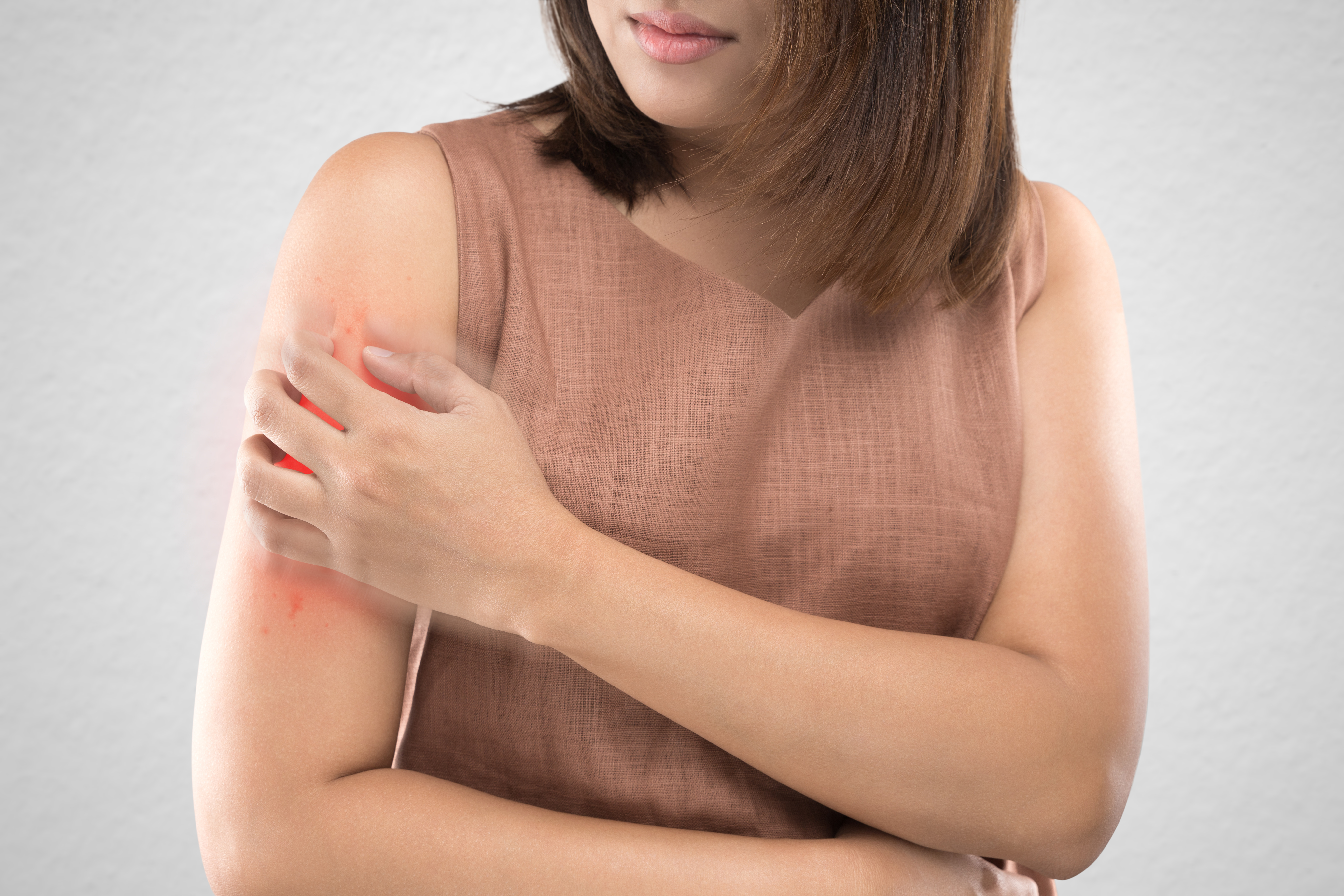 A woman itching a rash on her arm