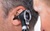 doctor looking into patients ear using a medical ear microscope