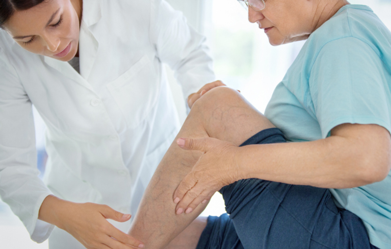 Doctor assessing a patient's leg for eligibility for Veinwave treatment for thread veins