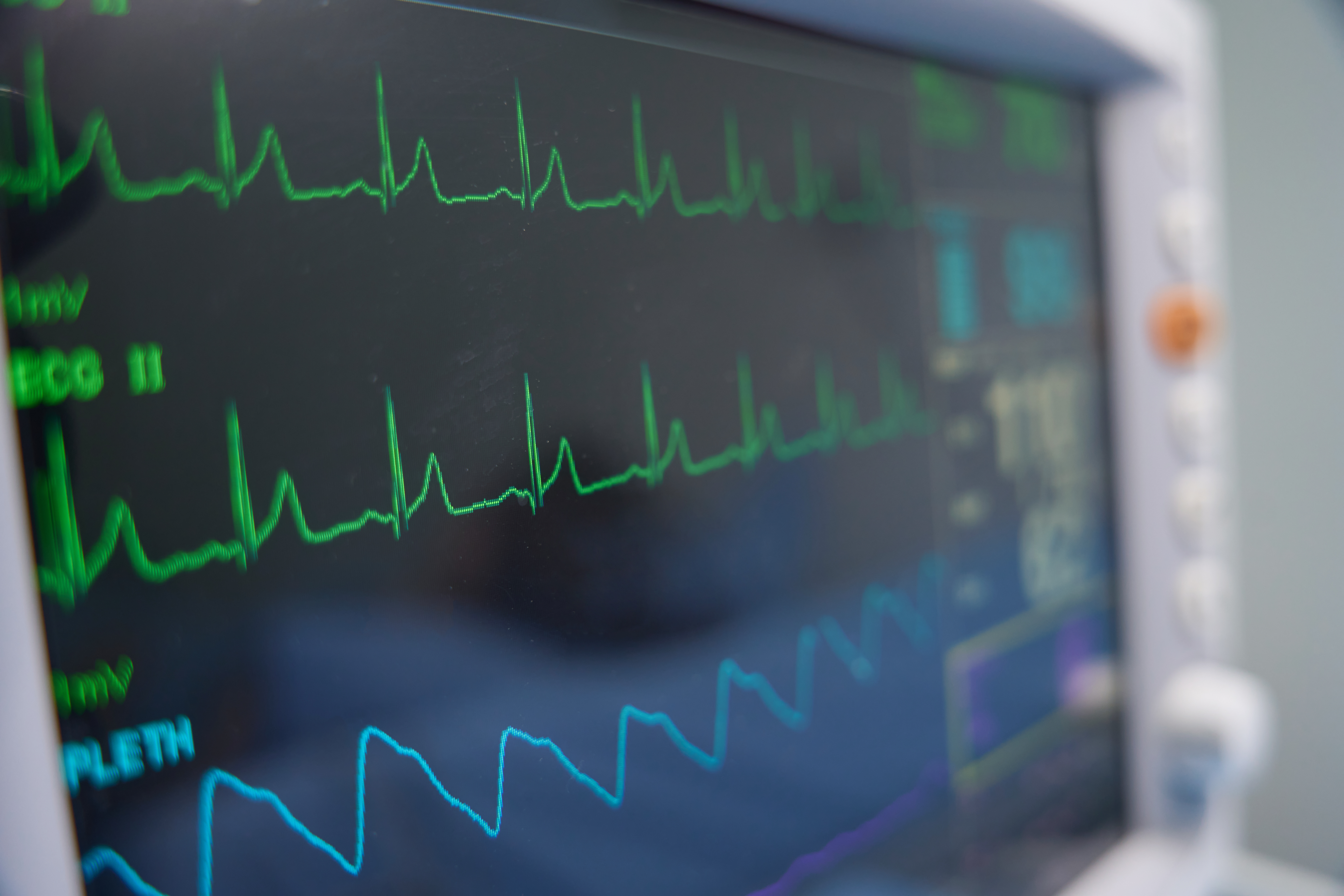 Heart monitor